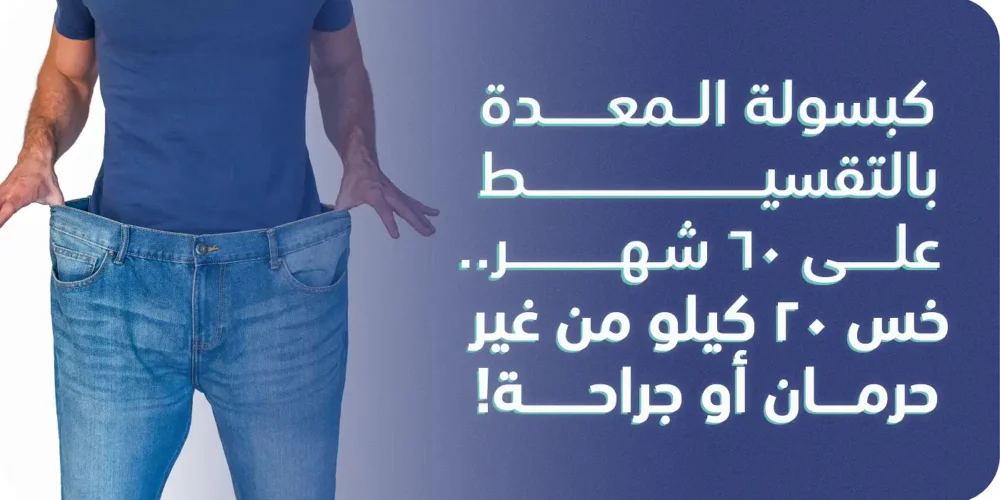 كبسولة المعدة بالتقسيط