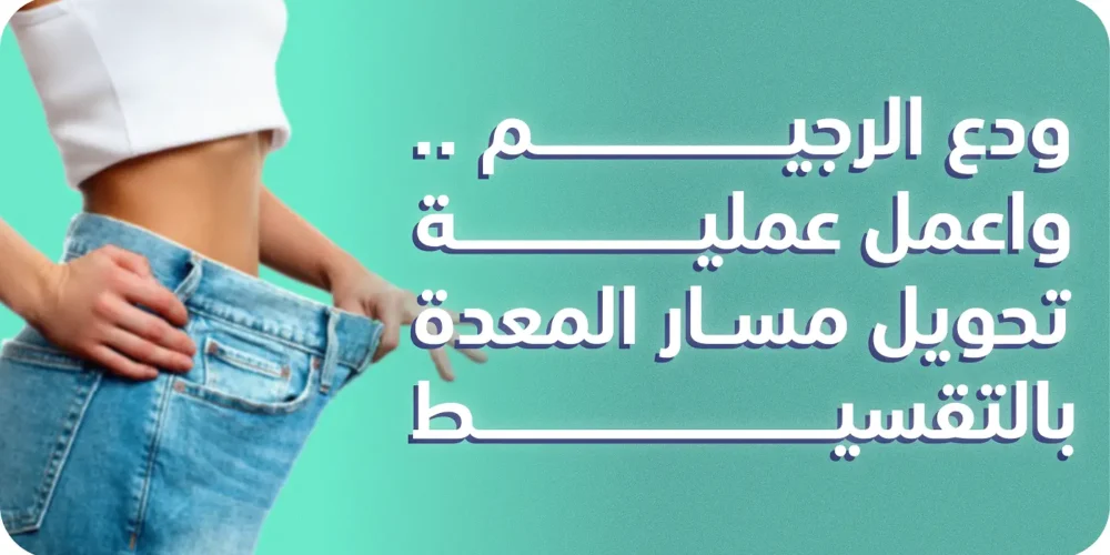 عملية تحويل مسار المعدة بالتقسيط